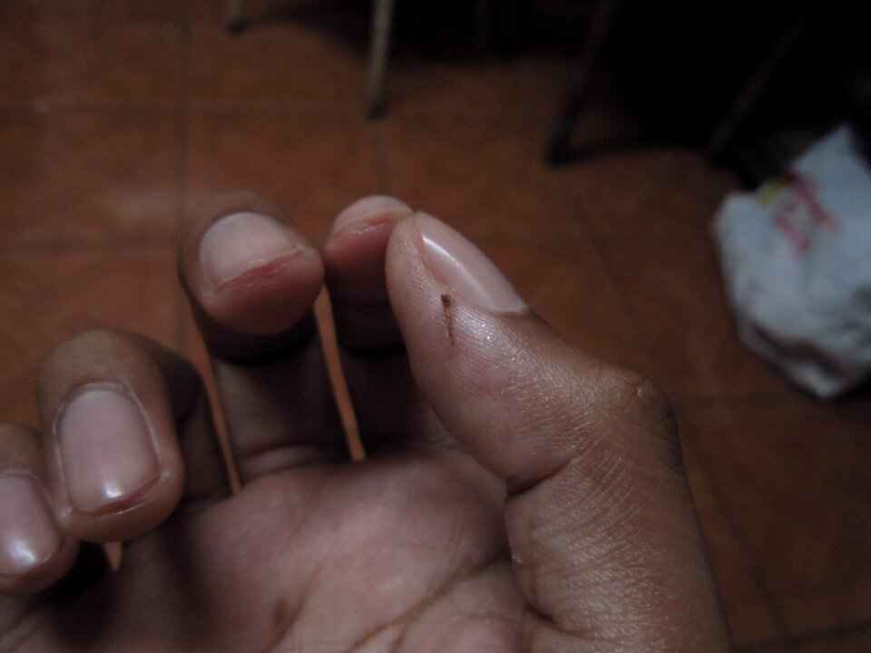 Free stock photo of finger, splinter, theme look-down