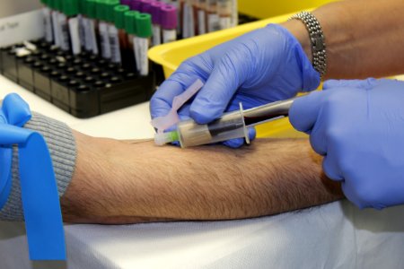 Injection, Arm, Service, Hand