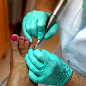 Nail, Finger, Hand, Medical Glove