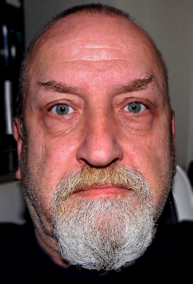 Facial Hair, Beard, Hair, Eyebrow