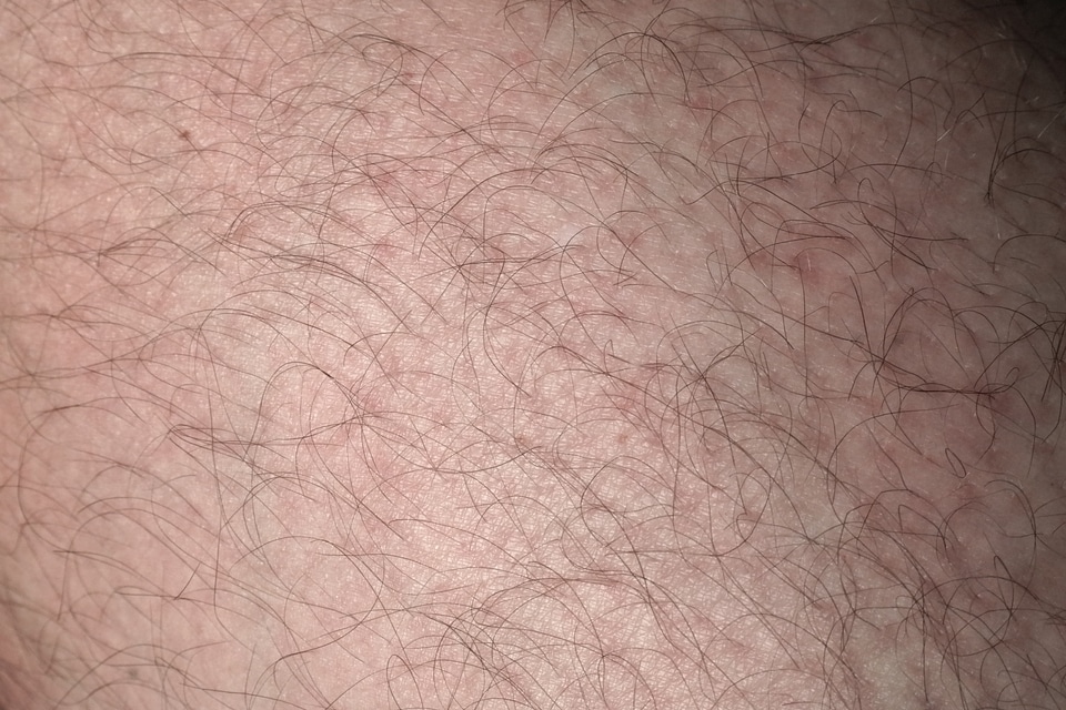 Leg leg hair human