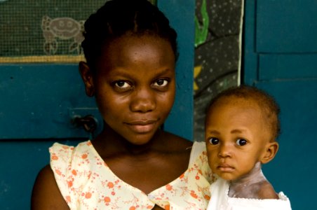 Child Girl Head Eye