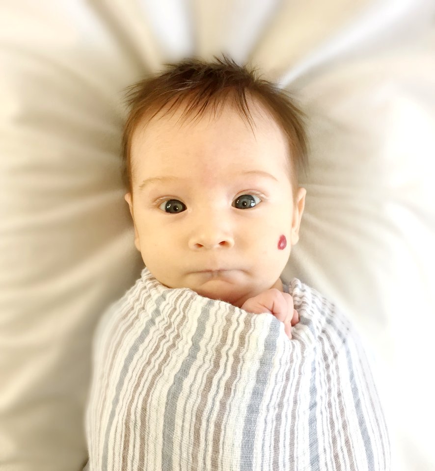 Face Child Skin Infant photo