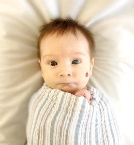 Face Child Skin Infant photo