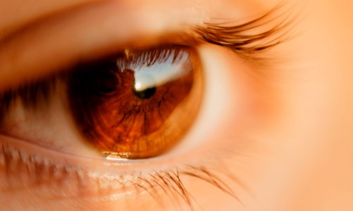 Close-up Photo Of Unpaired Brown Eye photo