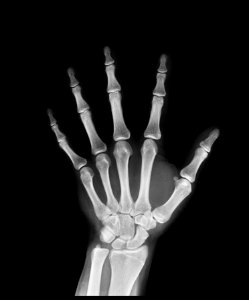 Black-and-white Bones Hand photo