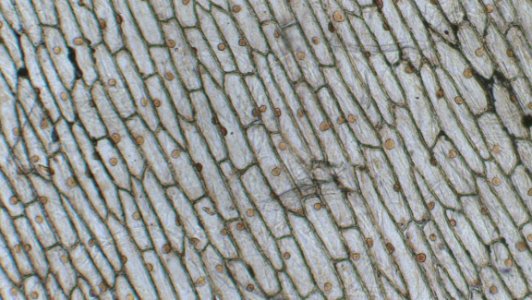 Living Cells Of Onion Epidermis