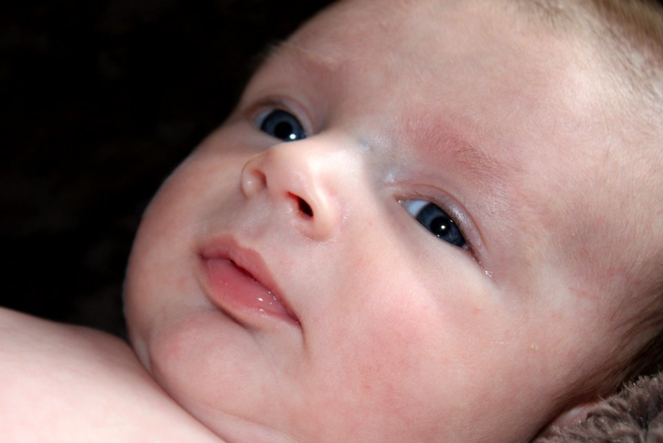 Infant Child Face Cheek