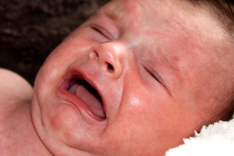 Face Infant Nose Skin