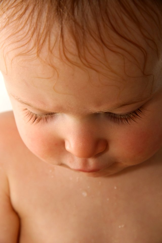 Face Skin Nose Cheek