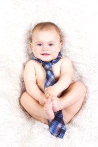 Photograph Skin Child Infant