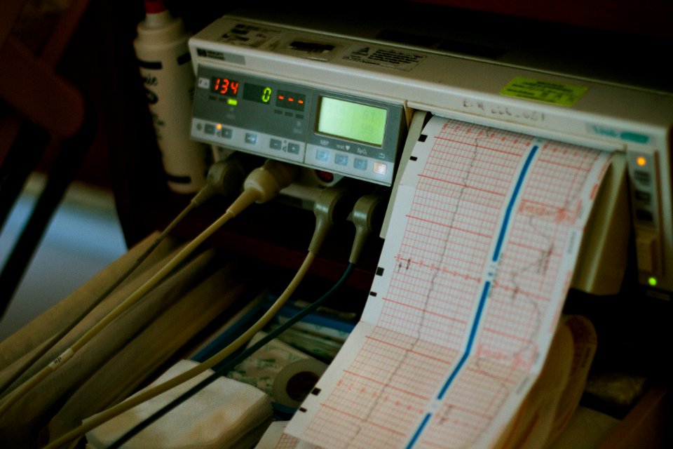 Equipment With Pen Recorder And Chart