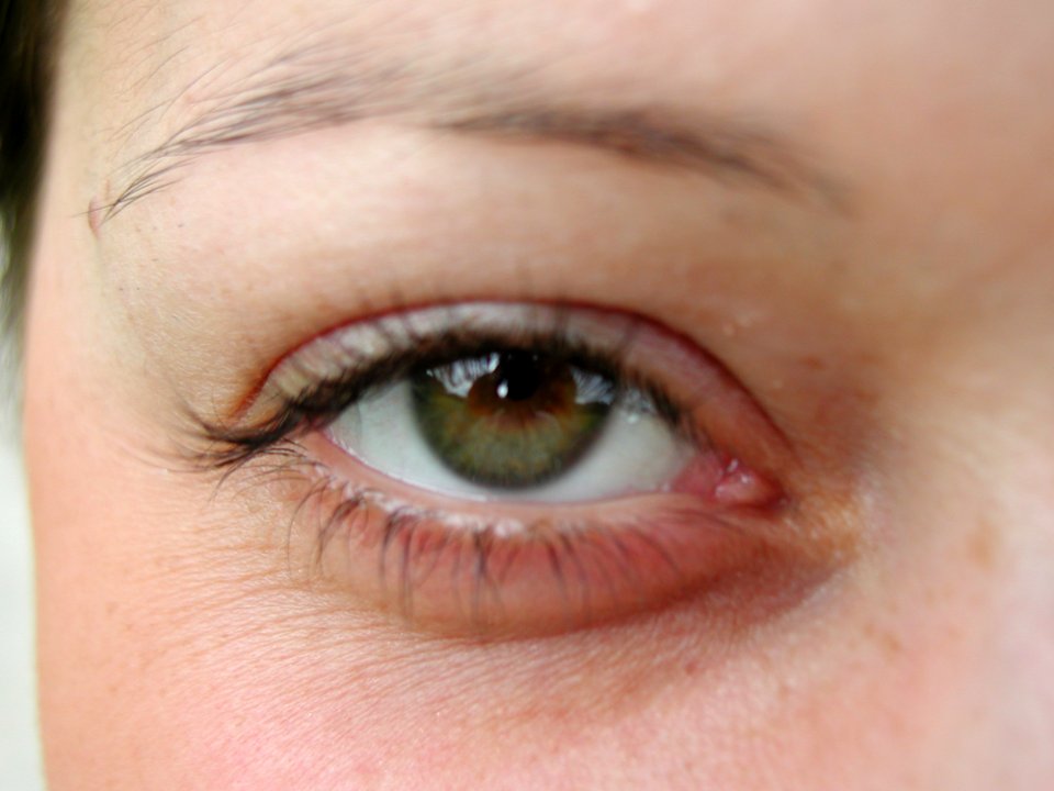 Eye Open