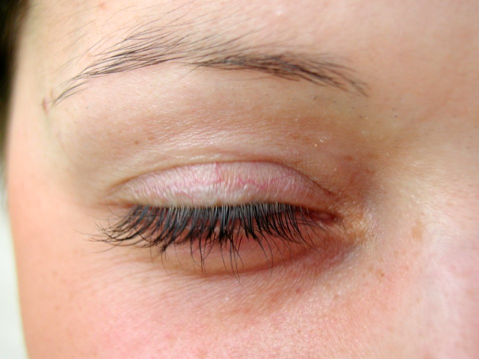Eye Closed