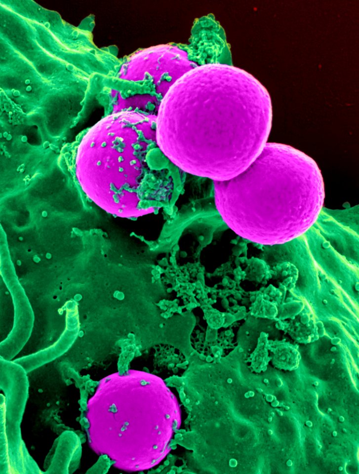 Pink Sphere Splashed By Green Liquid