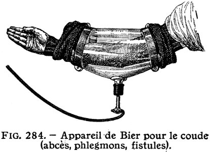 Apareil De Bier-coude