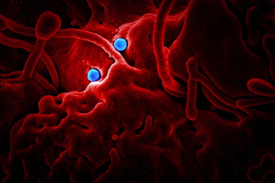 Ultrastructural morphology shown by coronavirus. Original image sourced from US Government department: Public Health Image Library, Centers for Disease Control and Prevention. Under US law this image is copyright free, please credit the government department whenever you can”. photo