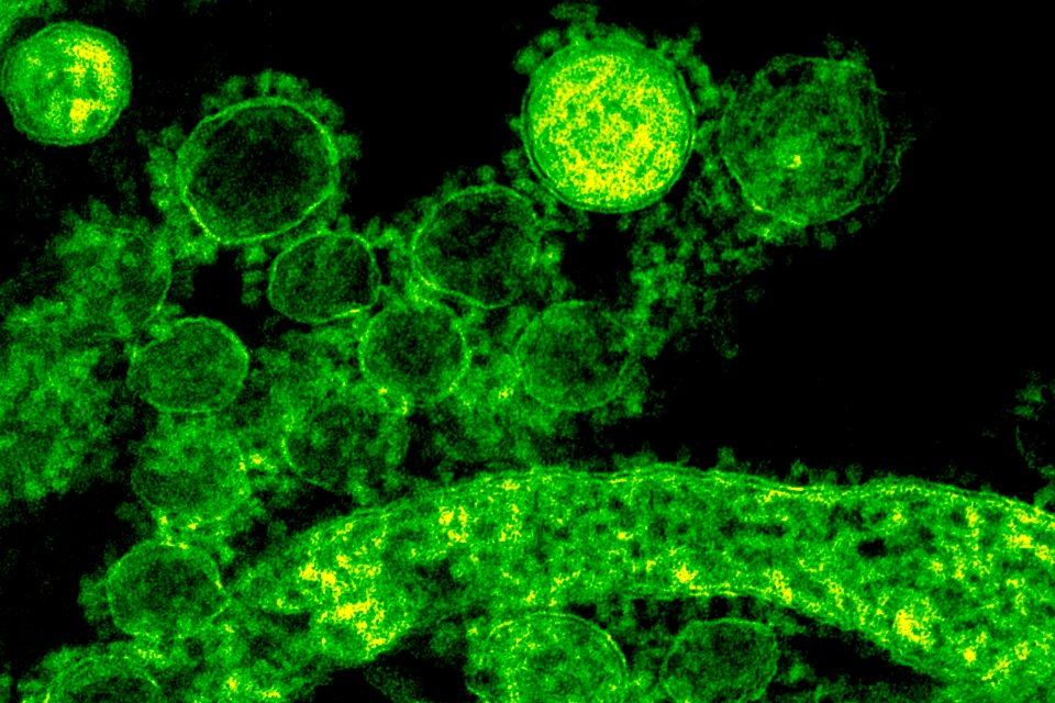 Green coronavirus under a microscope. Original image sourced from US Government department: Public Health Image Library, Centers for Disease Control and Prevention. Under US law this image is copyright free, please credit the government department whenever you can”. photo