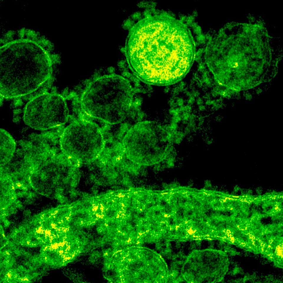 Green coronavirus under a microscope. Original image sourced from US Government department: Public Health Image Library, Centers for Disease Control and Prevention. Under US law this image is copyright free, please credit the government department whenever you can”. photo