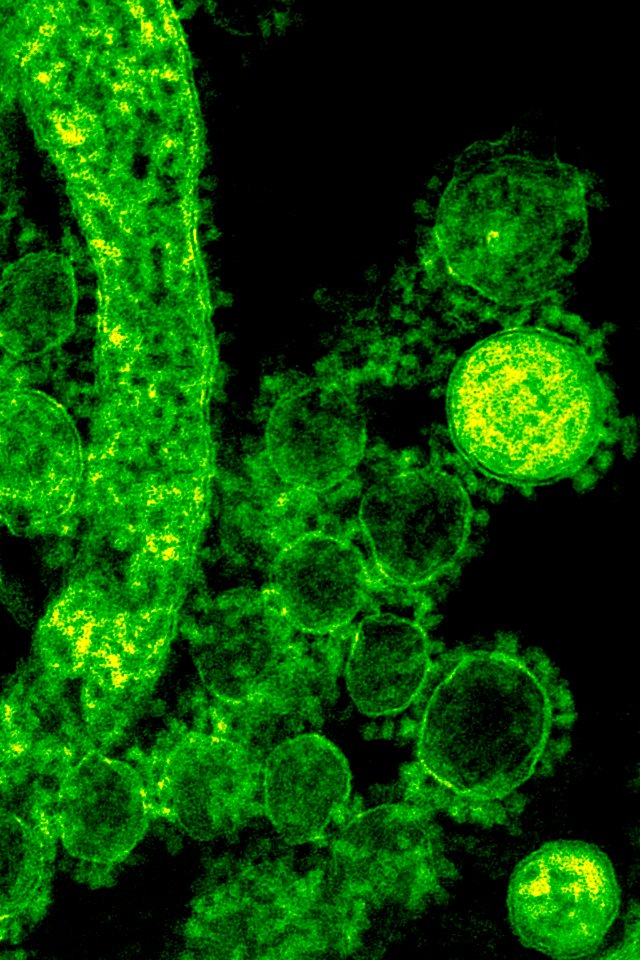 Green coronavirus under a microscope. A healthcare provider donning a pair of green latex gloves in order to protect herself during her subsequent interaction her next patient. Original image sourced from US Government department: Public Health Image Library, Centers for Disease Control and Prevention. Under US law this image is copyright free, please credit the government department whenever you can”.