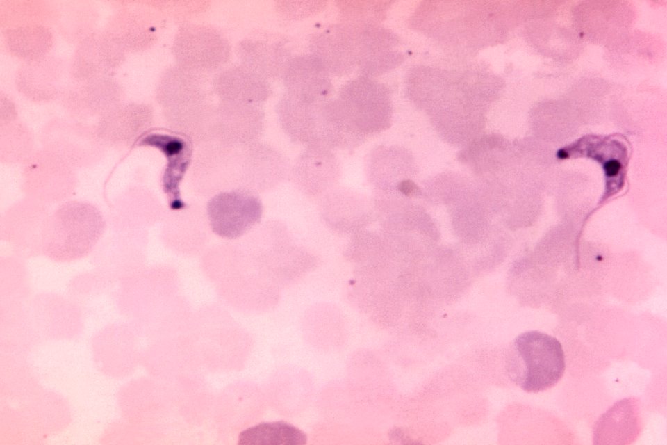 Photomicrograph of a blood smear specimen. Original image sourced from US Government department: Public Health Image Library, Centers for Disease Control and Prevention. Under US law this image is copyright free, please credit the government department whenever you can”.