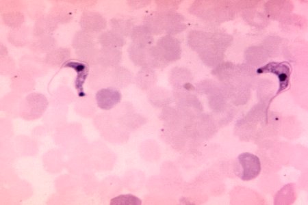 Photomicrograph of a blood smear specimen. Original image sourced from US Government department: Public Health Image Library, Centers for Disease Control and Prevention. Under US law this image is copyright free, please credit the government department whenever you can”. photo