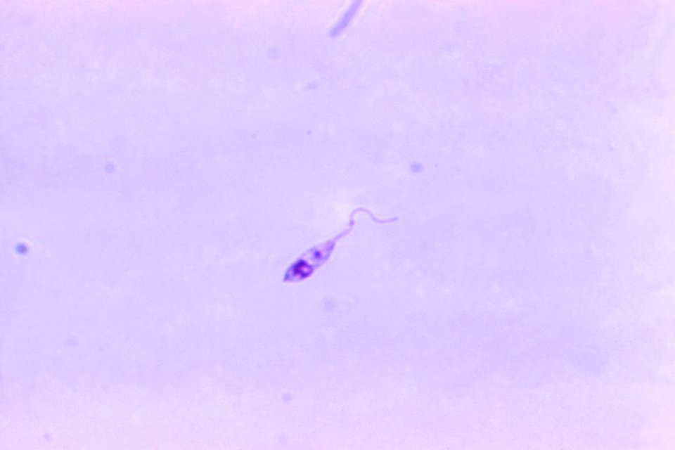 Photomicrograph of a parasite. Original image sourced from US Government department: Public Health Image Library, Centers for Disease Control and Prevention. Under US law this image is copyright free, please credit the government department whenever you can”.