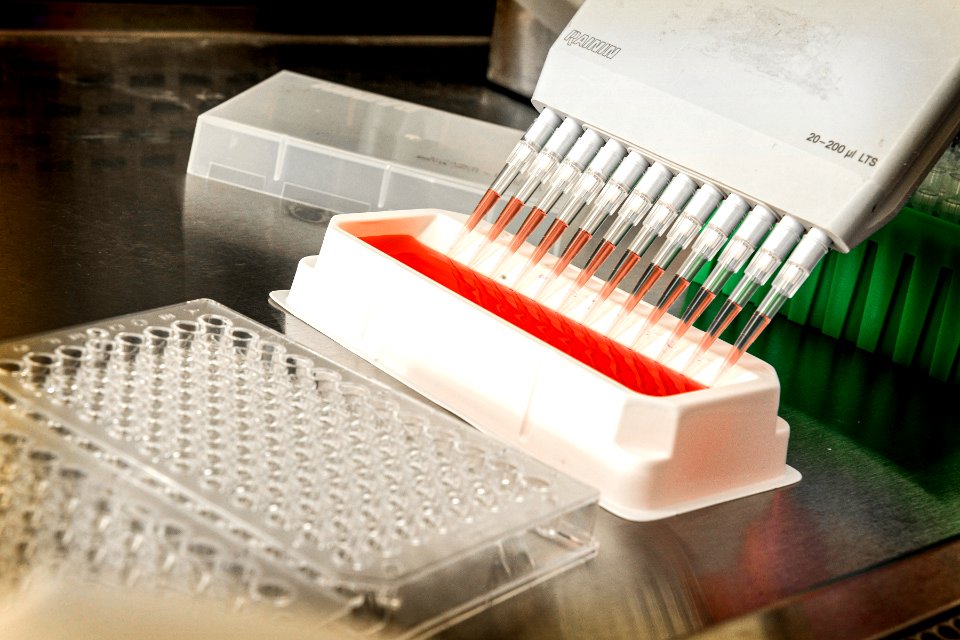 Test Tubes from experimenting on coronavirus. Original image sourced from US Government department: Public Health Image Library, Centers for Disease Control and Prevention. Under US law this image is copyright free, please credit the government department whenever you can”.