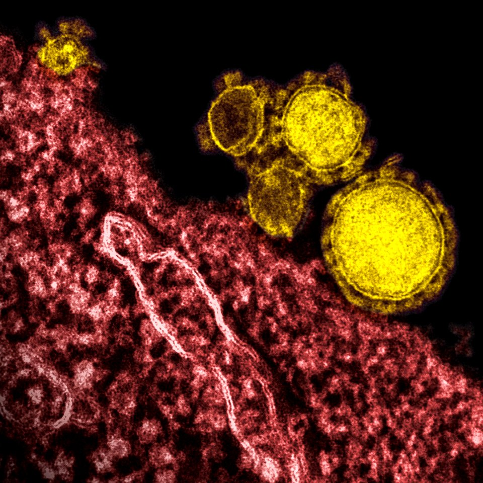 Magnified respiratory syndrome coronavirus. Original image sourced from US Government department: Public Health Image Library, Centers for Disease Control and Prevention. Under US law this image is copyright free, please credit the government department whenever you can”.