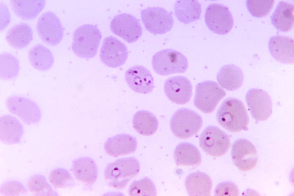 Photomicrograph of a human blood smear. Original image sourced from US Government department: Public Health Image Library, Centers for Disease Control and Prevention. Under US law this image is copyright free, please credit the government department whenever you can”.