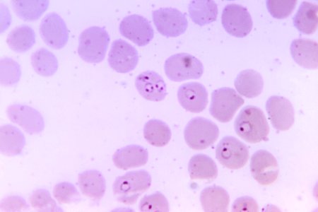 Photomicrograph of a human blood smear. Original image sourced from US Government department: Public Health Image Library, Centers for Disease Control and Prevention. Under US law this image is copyright free, please credit the government department whenever you can”. photo