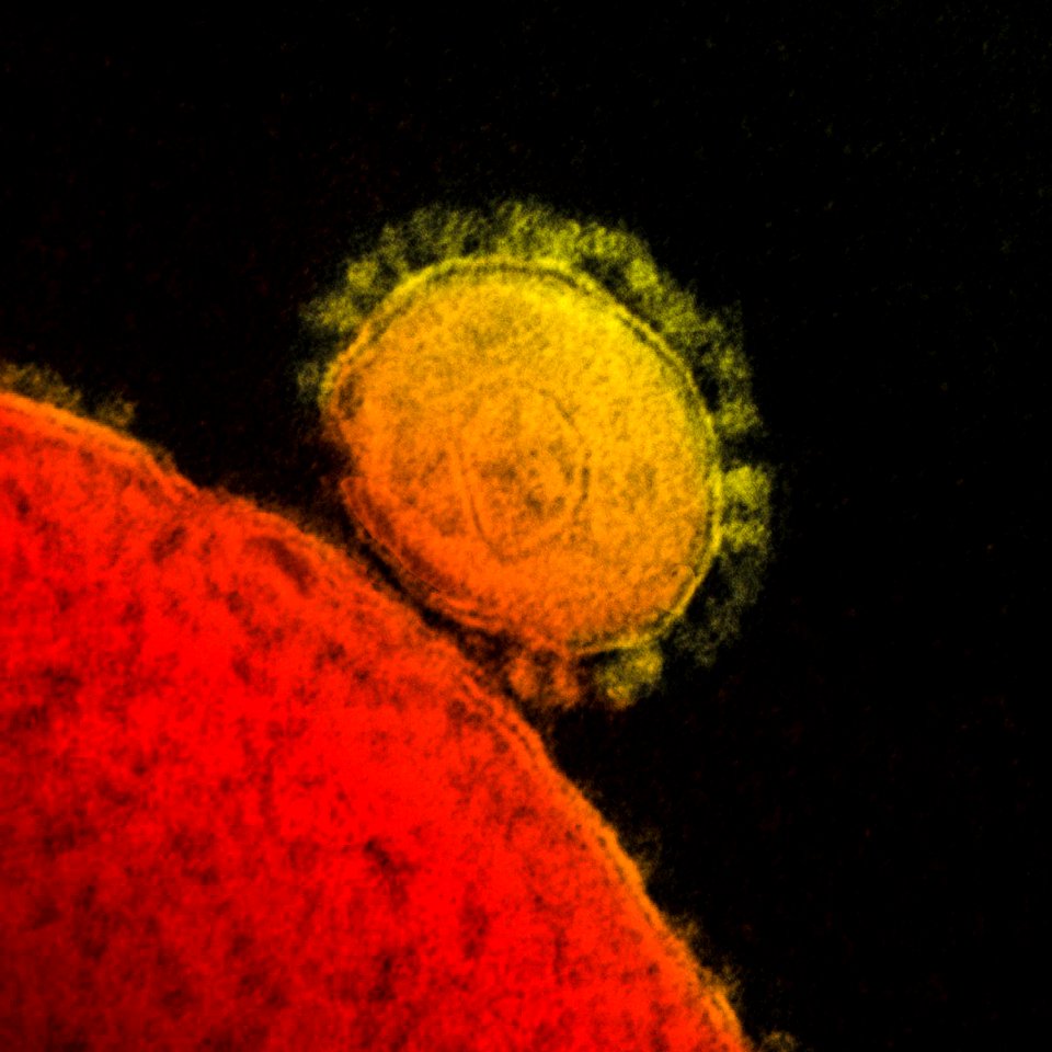 Magnified respiratory syndrome coronavirus. Original image sourced from US Government department: Public Health Image Library, Centers for Disease Control and Prevention. Under US law this image is copyright free, please credit the government department whenever you can”. photo