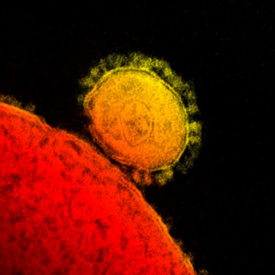 Magnified respiratory syndrome coronavirus. Original image sourced from US Government department: Public Health Image Library, Centers for Disease Control and Prevention. Under US law this image is copyright free, please credit the government department whenever you can”.