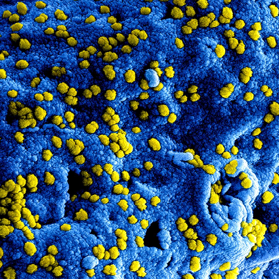 Magnified respiratory syndrome coronavirus. Original image sourced from US Government department: Public Health Image Library, Centers for Disease Control and Prevention. Under US law this image is copyright free, please credit the government department whenever you can”.