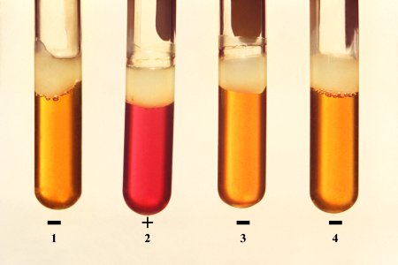 Four test tubes of bacterial microorganism. Original image sourced from US Government department: Public Health Image Library, Centers for Disease Control and Prevention. Under US law this image is copyright free, please credit the government department whenever you can”.