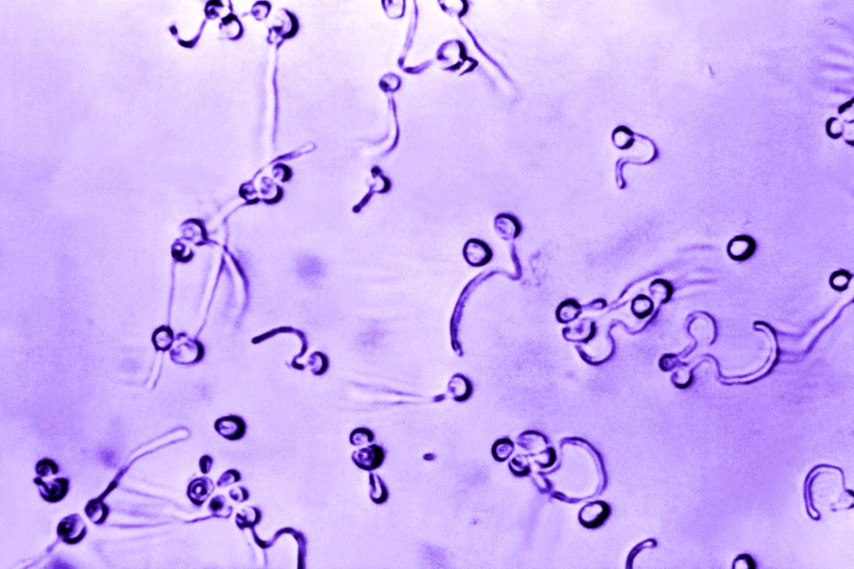 A photomicrograph of Candida albicans fungal spores. Original image sourced from US Government department: Public Health Image Library, Centers for Disease Control and Prevention. Under US law this image is copyright free, please credit the government department whenever you can”.