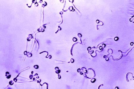 A photomicrograph of Candida albicans fungal spores. Original image sourced from US Government department: Public Health Image Library, Centers for Disease Control and Prevention. Under US law this image is copyright free, please credit the government department whenever you can”. photo