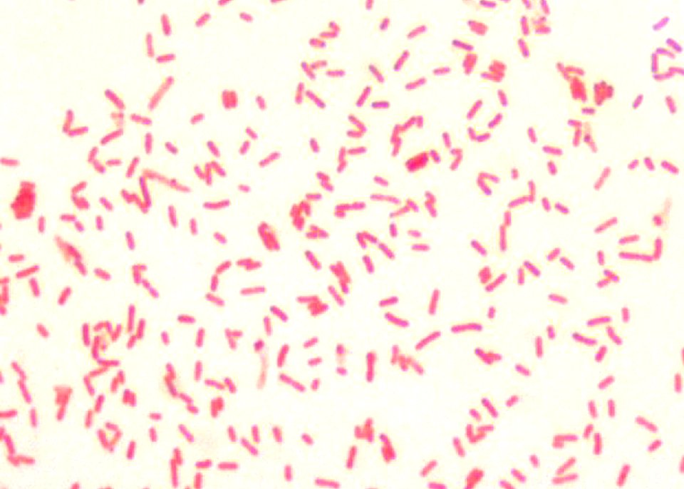 A 1000X photomicrograph magnification of numerous, rod-shaped, Gram–negative, Yersinia pestis bacilli. Original image sourced from US Government department: Public Health Image Library, Centers for Disease Control and Prevention. Under US law this image is copyright free, please credit the government department whenever you can”.
