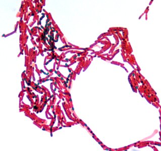 A 100X photomicrograph magnification of a malachite green spore stained sample, revealed the presence of numerous Bacillus sp. bacteria. Original image sourced from US Government department: Public Health Image Library, Centers for Disease Control and Prevention. Under US law this image is copyright free, please credit the government department whenever you can”.