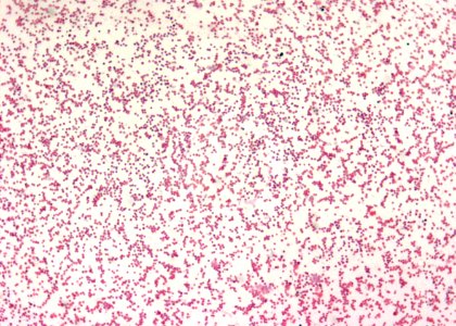 A photomicrograph reveals numerous Gram–negative, Francisella tularensis coccobacilli, the bacterium responsible for causing the disease, tularemia. Original image sourced from US Government department: Public Health Image Library, Centers for Disease Control and Prevention. Under US law this image is copyright free, please credit the government department whenever you can”.