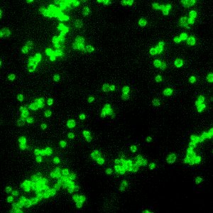 A photomicrograph of a direct fluorescent antibody (DFA)–stained specimen, revealing the presence of numerous Francisella tularensis coccobacilli. Original image sourced from US Government department: Public Health Image Library, Centers for Disease Control and Prevention. Under US law this image is copyright free, please credit the government department whenever you can”.