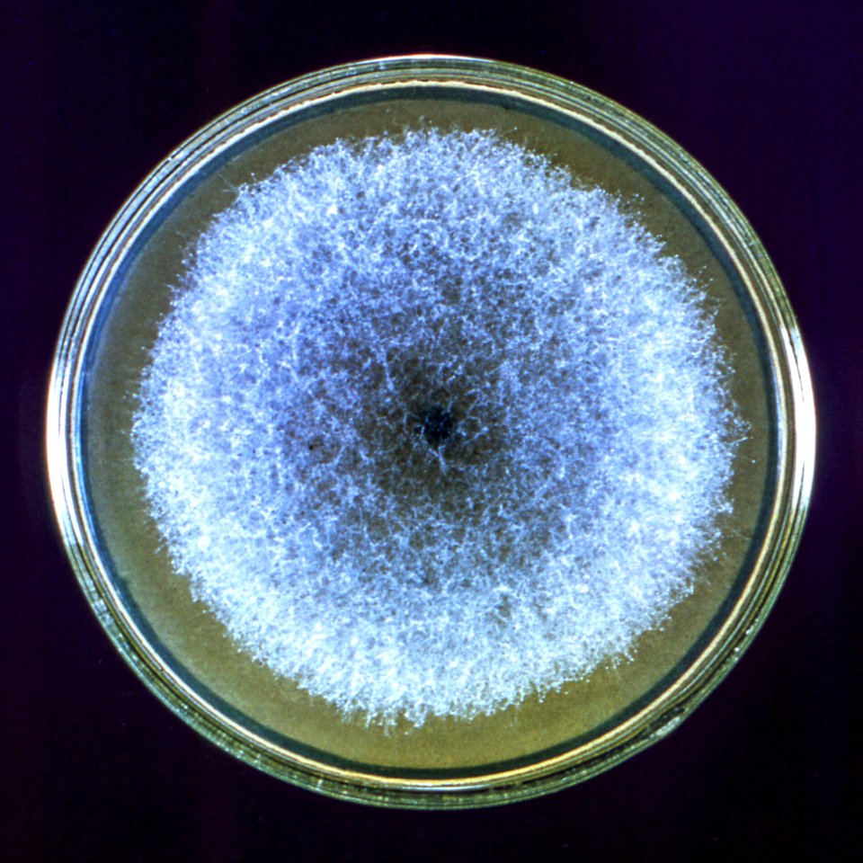 A Petri dish culture plate containing a growth medium of Sabouraud dextrose agar, which had been inoculated with the fungal organism from the genus, Syncephalastrum, strain A-423. Original image sourced from US Government department: Public Health Image Library, Centers for Disease Control and Prevention. Under US law this image is copyright free, please credit the government department whenever you can”.