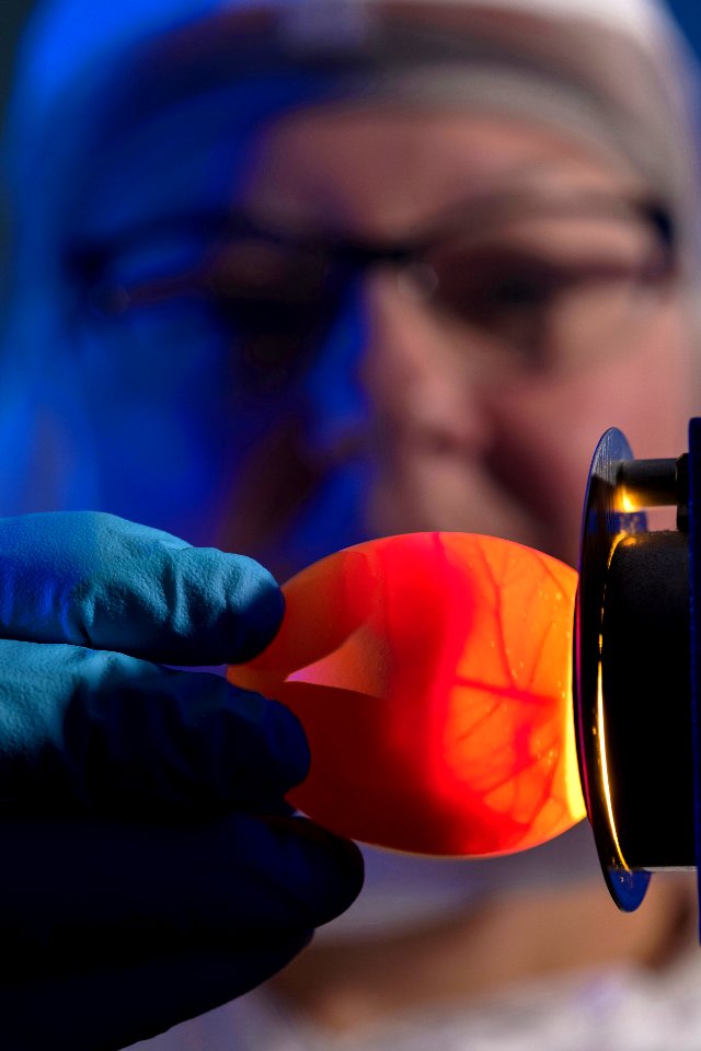 A scientist demonstrating a lab technique called “candling,” which determines if the egg is suitable for use in growing flu viruses. Original image sourced from US Government department: Public Health Image Library, Centers for Disease Control and Prevention. Under US law this image is copyright free, please credit the government department whenever you can”. photo