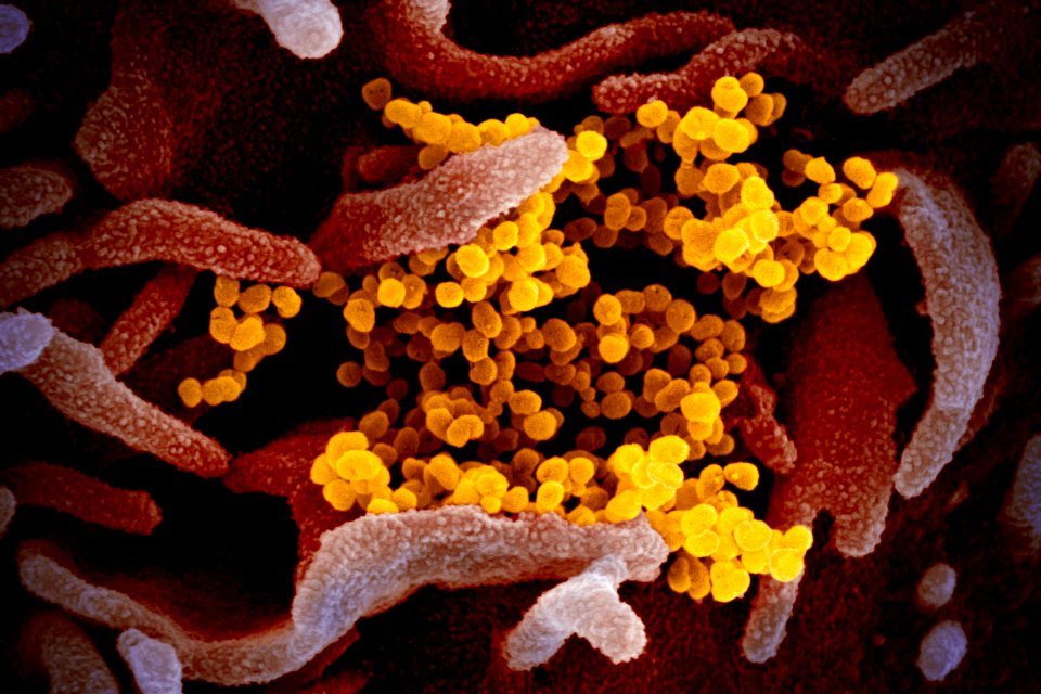 Novel Coronavirus SARS-CoV-2–
This scanning electron microscope image shows SARS-CoV-2 (yellow)—also known as 2019-nCoV, the virus that causes COVID-19. Original image sourced from US Government department: The National Institute of Allergy and Infectious Diseases. Under US law this image is copyright free, please credit the government department whenever you can”.