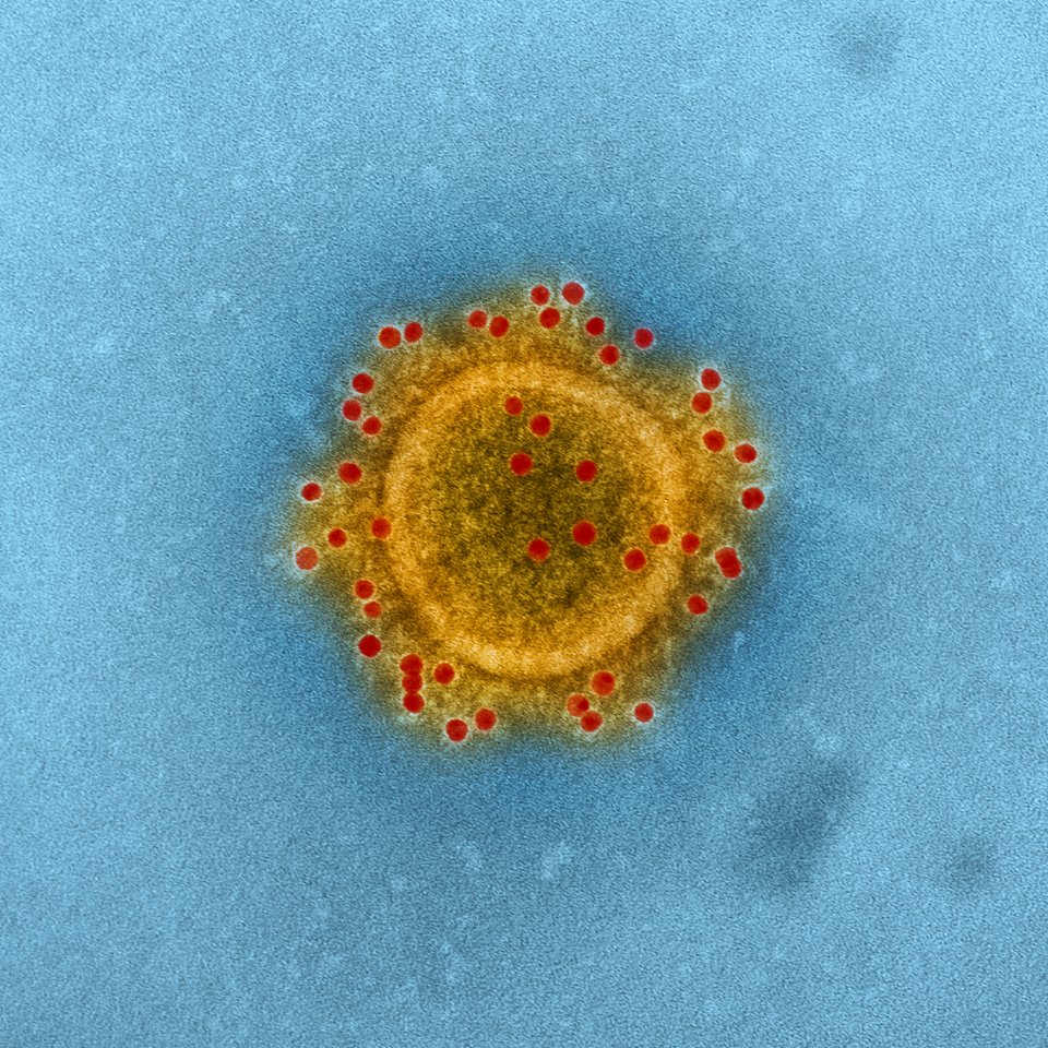 MERS Coronavirus Particle–Middle East Respiratory Syndrome Coronavirus particle envelope proteins immunolabeled with Rabbit HCoV-EMC/2012 primary antibody and Goat anti-Rabbit 10 nm gold particles. Original image sourced from US Government department: The National Institute of Allergy and Infectious Diseases. Under US law this image is copyright free, please credit the government department whenever you can”. photo