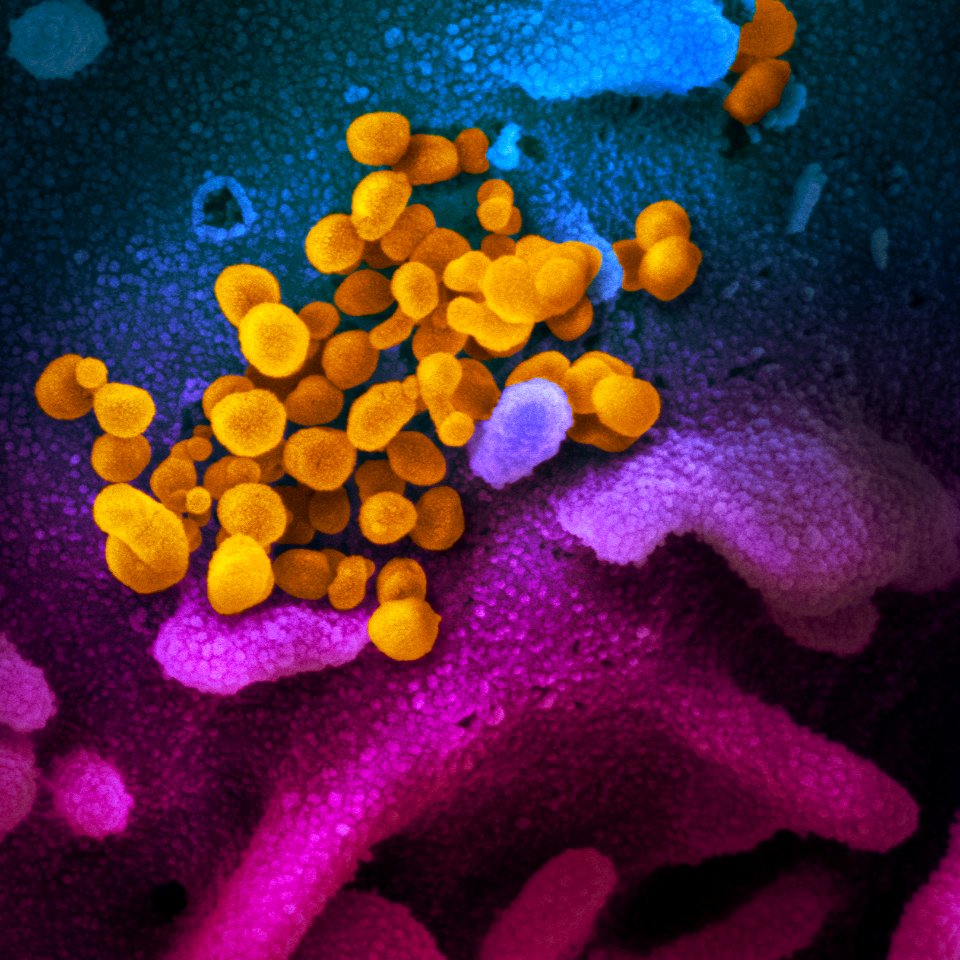 Novel Coronavirus SARS-CoV-2–This scanning electron microscope image shows SARS-CoV-2 (yellow)—also known as 2019-nCoV, the virus that causes COVID-19. Original image sourced from US Government department: The National Institute of Allergy and Infectious Diseases. Under US law this image is copyright free, please credit the government department whenever you can”.