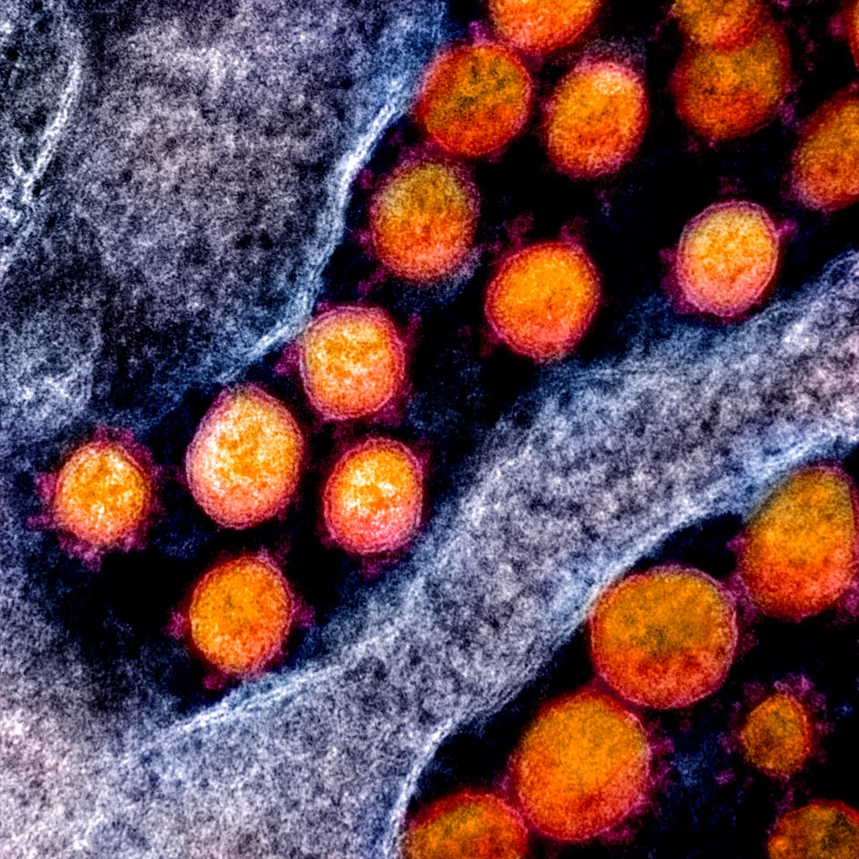 Novel Coronavirus SARS-CoV-2–Transmission electron micrograph of SARS-CoV-2 virus particles, isolated from a patient. Original image sourced from US Government department: The National Institute of Allergy and Infectious Diseases. Under US law this image is copyright free, please credit the government department whenever you can”.