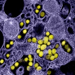 Novel Coronavirus SARS-CoV-2–Transmission electron micrograph of SARS-CoV-2 virus particles, isolated from a patient. Original image sourced from US Government department: The National Institute of Allergy and Infectious Diseases. Under US law this image is copyright free, please credit the government department whenever you can”.