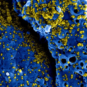 MERS Coronavirus Particles–Colorized scanning electron micrograph of MERS virus particles (yellow) both budding and attached to the surface of infected VERO E6 cells (blue). Original image sourced from US Government department: The National Institute of Allergy and Infectious Diseases. Under US law this image is copyright free, please credit the government department whenever you can”. photo