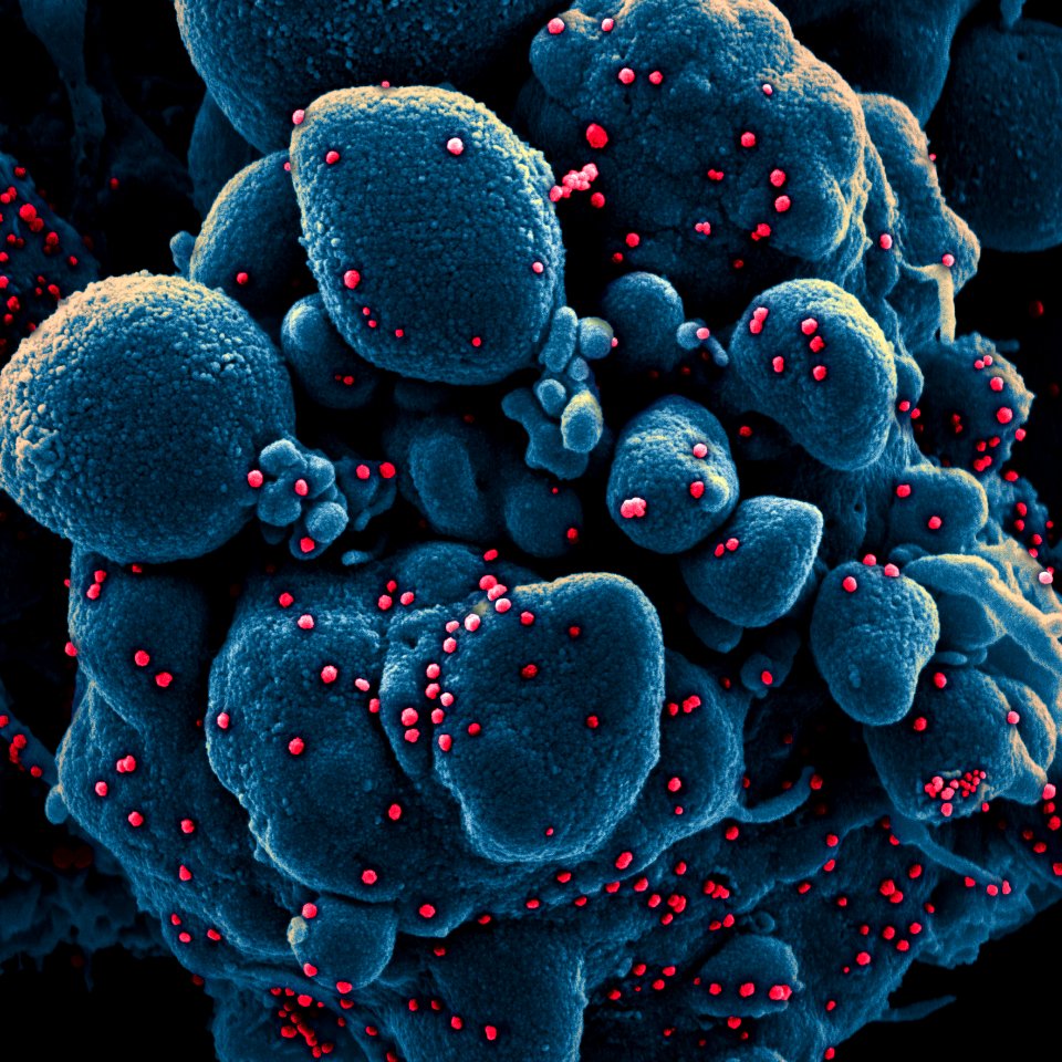 Novel Coronavirus SARS-CoV-2–Colorized scanning electron micrograph of an apoptotic cell (blue) infected with SARS-COV-2 virus particles (red), isolated from a patient sample. Original image sourced from US Government department: The National Institute of Allergy and Infectious Diseases. Under US law this image is copyright free, please credit the government department whenever you can”.